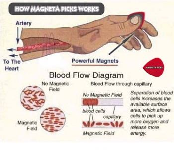 Magneta Picks. Эффект притока крови к кисти